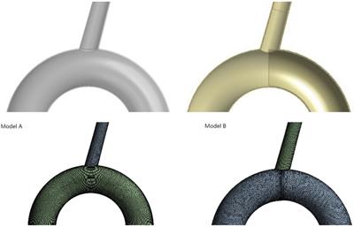 Hemodynamic changes for half cover left subclavian artery ostium during thoracic endovascular aortic repair